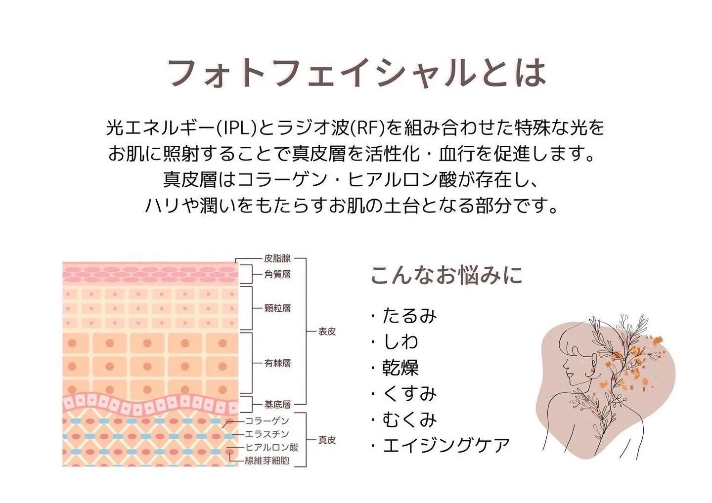 ▶︎▶︎光FAでツルスベ肌を目指しませんか？✨